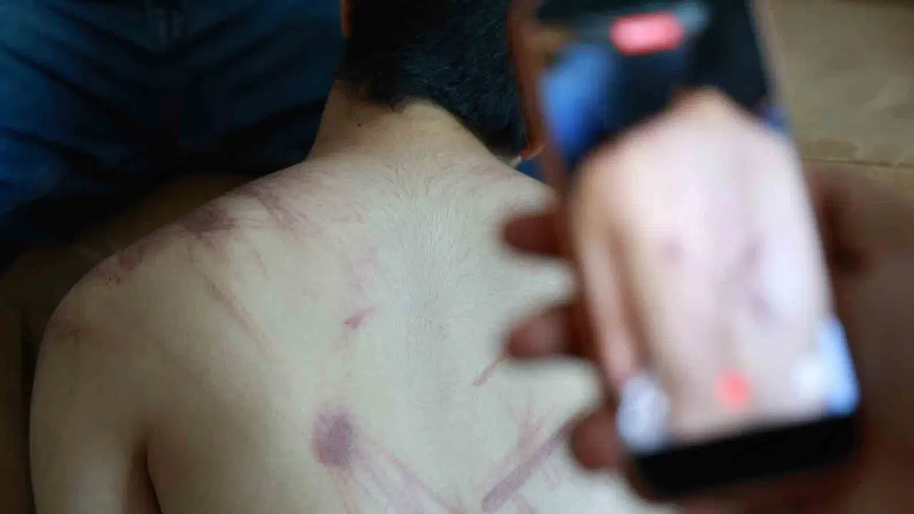Elazığ’da rehabilitasyon merkezinde ‘şiddet’ iddiası: Adli ve idari soruşturma başlatıldı Img